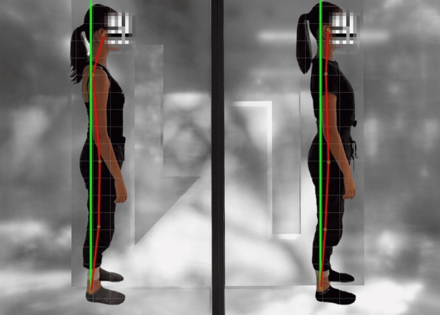 Posture scan before and after