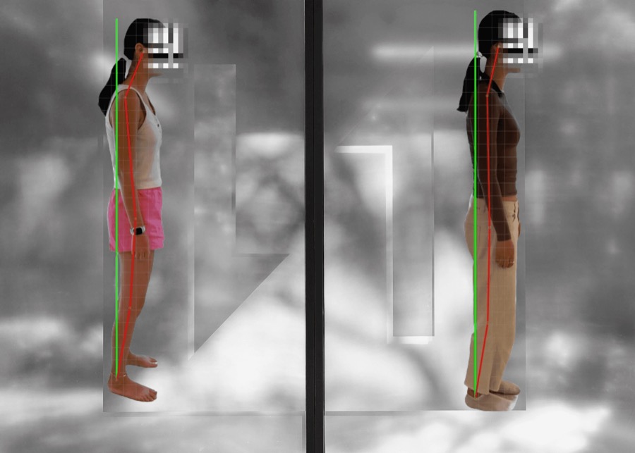 Posture scan before and after